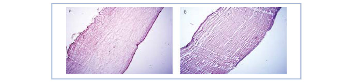 Гистологический срез роговицы кроликов на 4-е сутки экспериментального увеита